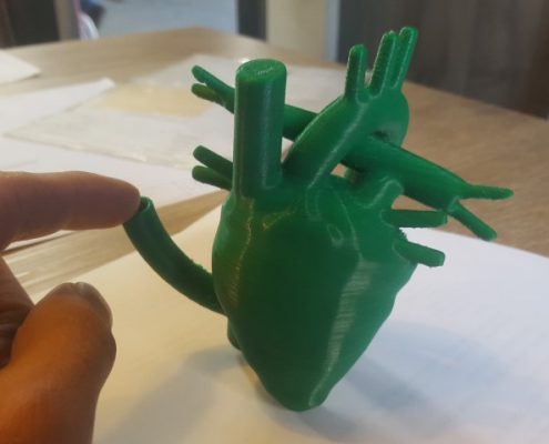 3D printer - Menselijk hart